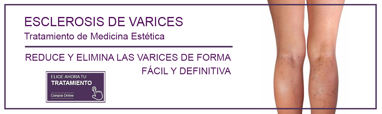 Esclerosis de Varices en Sevilla