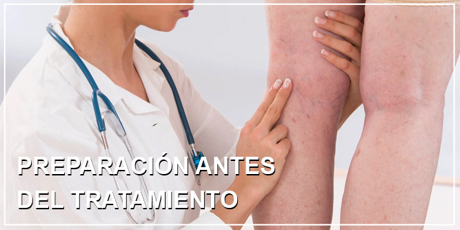 Esclerosis de Varices en Sevilla