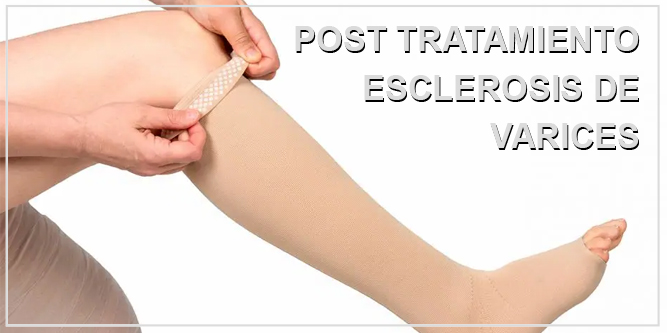 Esclerosis de Varices en Sevilla