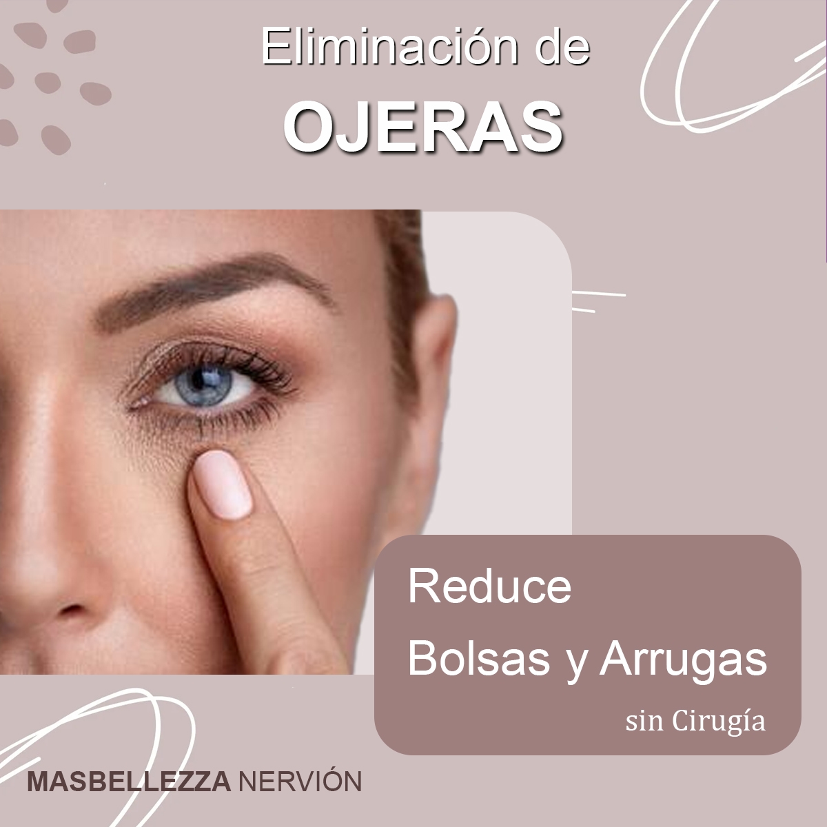 Reducción de las Ojeras en Sevilla