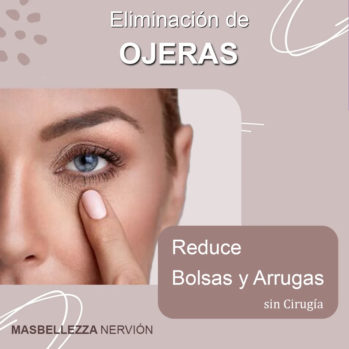 Reducción de las Ojeras en Sevilla
