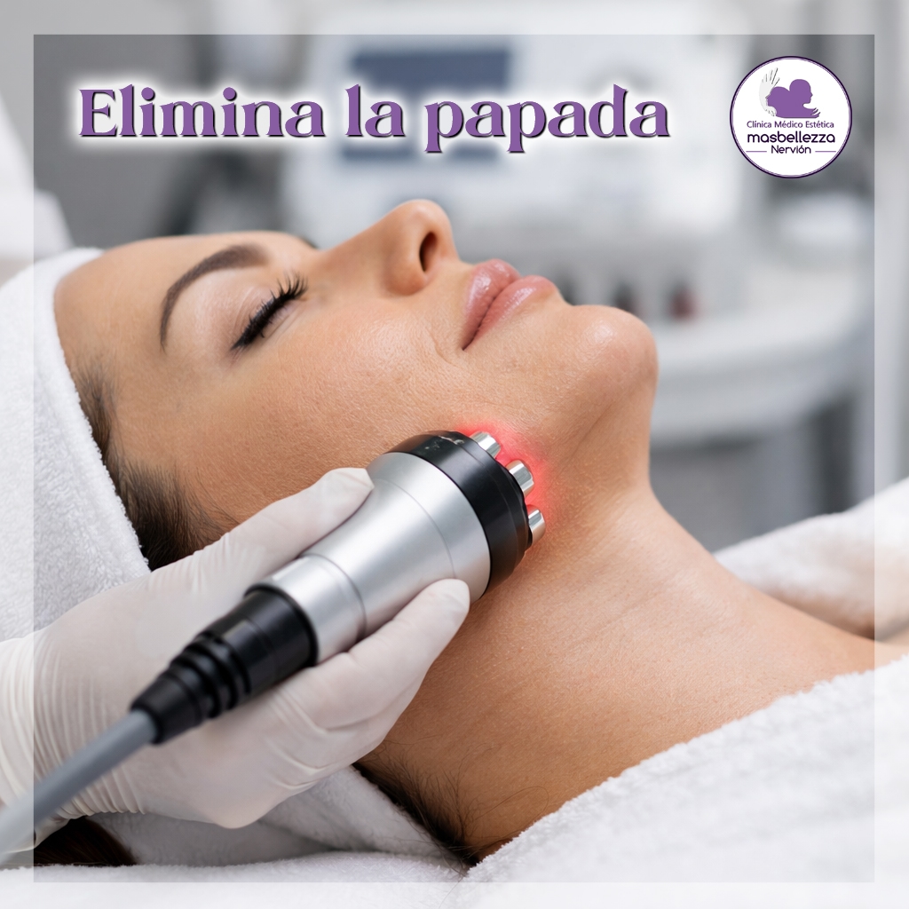 Eliminar papada sin cirugía en Sevilla