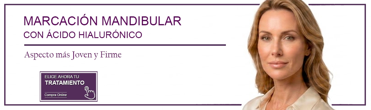 Marcación Mandibular con Ácido Hialurónico