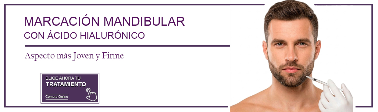  marcación mandibular con ácido hialurónico en Sevilla