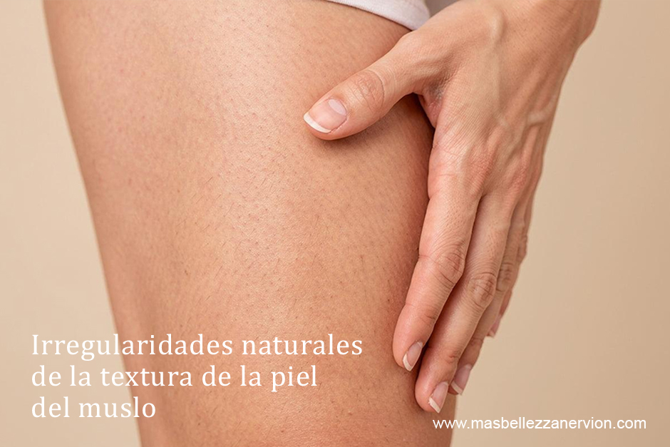 Irregularidades naturales de la textura de la piel del muslo