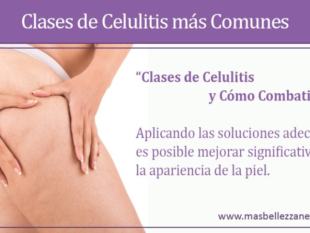 Clases de Celulitis más Comunes