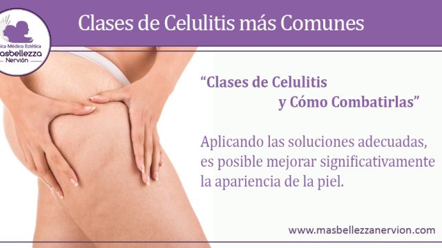 Clases de Celulitis más Comunes