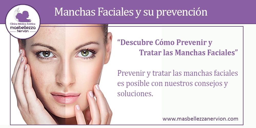 Manchas Faciales y su prevención