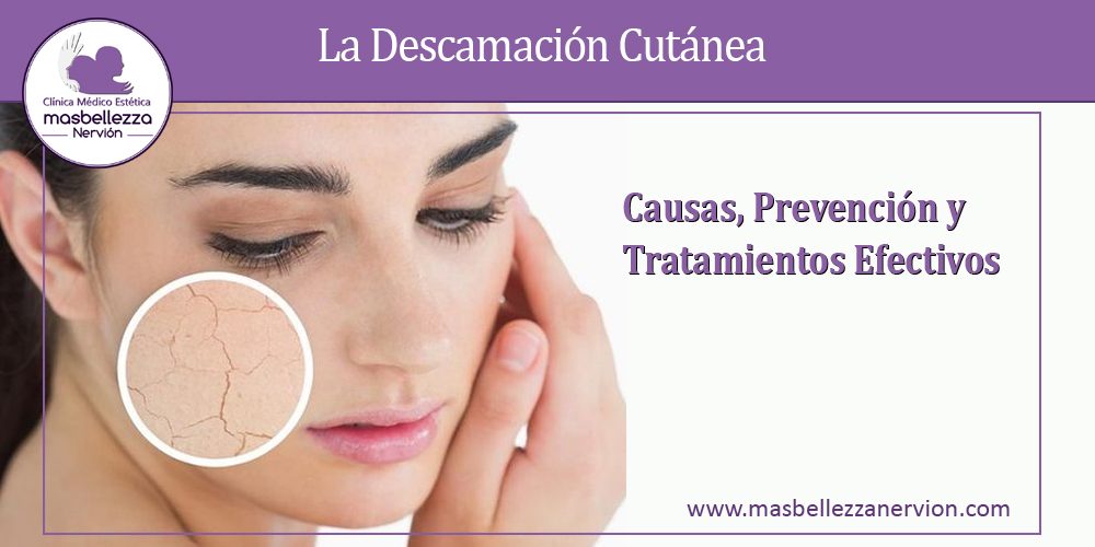 La Descamación Cutánea: Causas, Prevención y Tratamientos