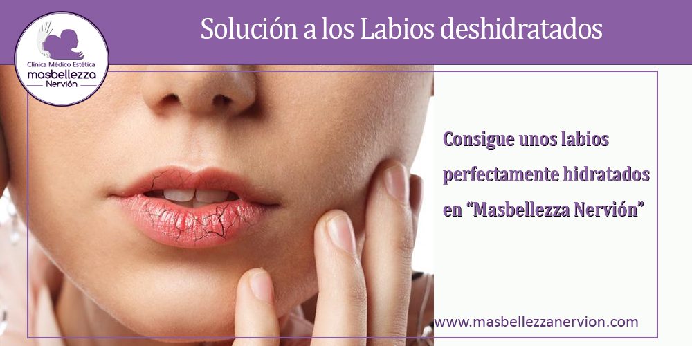 Solución a los Labios deshidratados