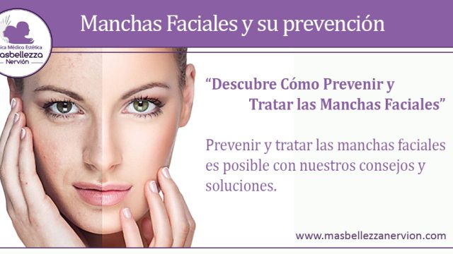 Manchas Faciales y su prevención