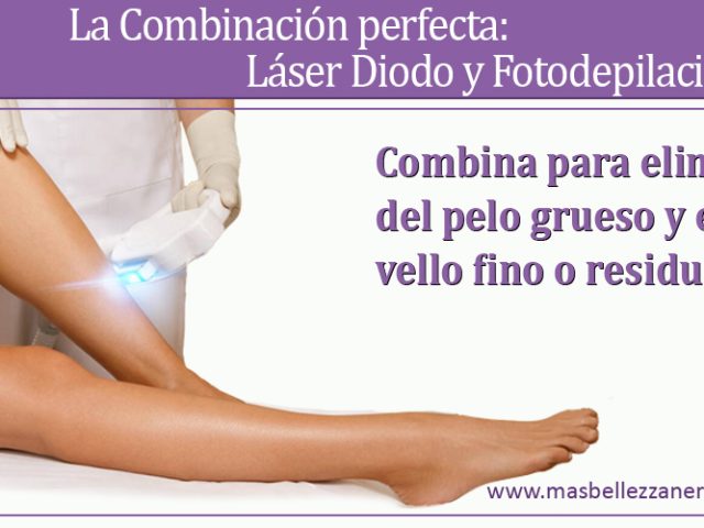 La Combinación perfecta: Láser Diodo y Fotodepilación IPL