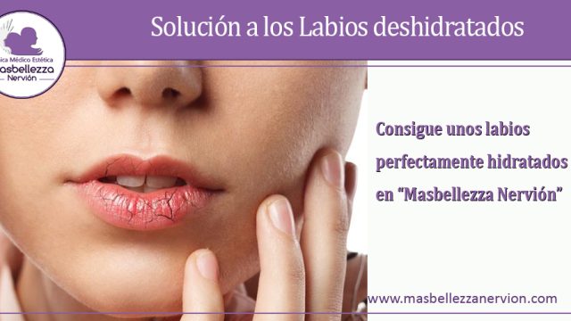 Solución a los Labios deshidratados