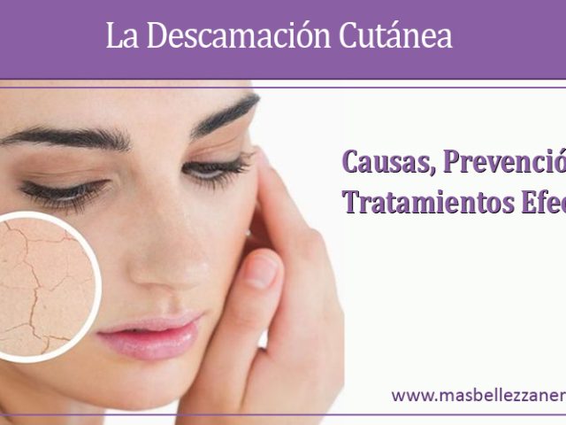 La Descamación Cutánea: Causas, Prevención y Tratamientos