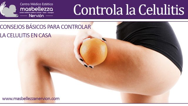 CONSEJOS BÁSICOS PARA CONTROLAR LA CELULITIS EN CASA