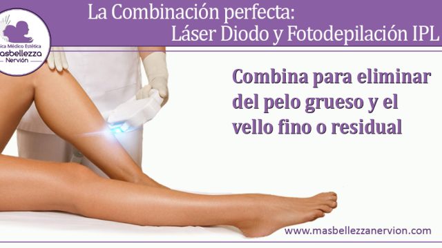 La Combinación perfecta: Láser Diodo y Fotodepilación IPL