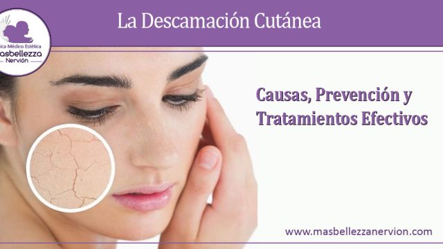 La Descamación Cutánea: Causas, Prevención y Tratamientos