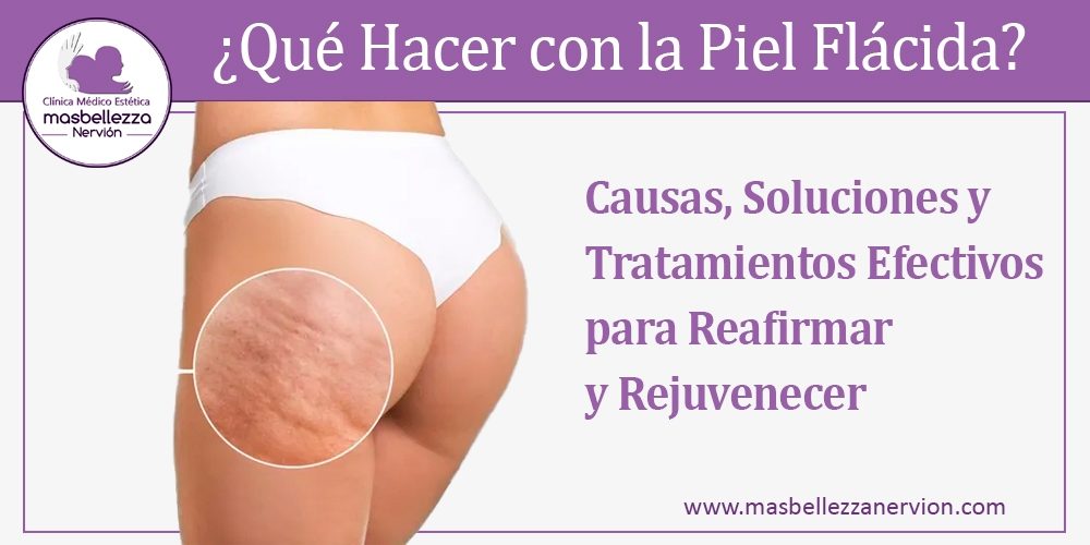 ¿Qué Hacer con la Piel Flácida? Tratamientos para Tensar y Rejuvenecer