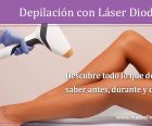 Depilación con Láser Diodo