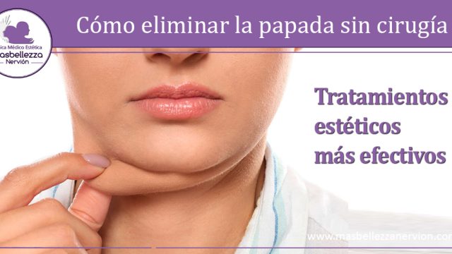 Cómo eliminar la papada sin cirugía