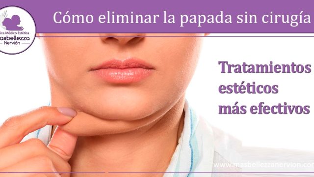Cómo eliminar la papada sin cirugía