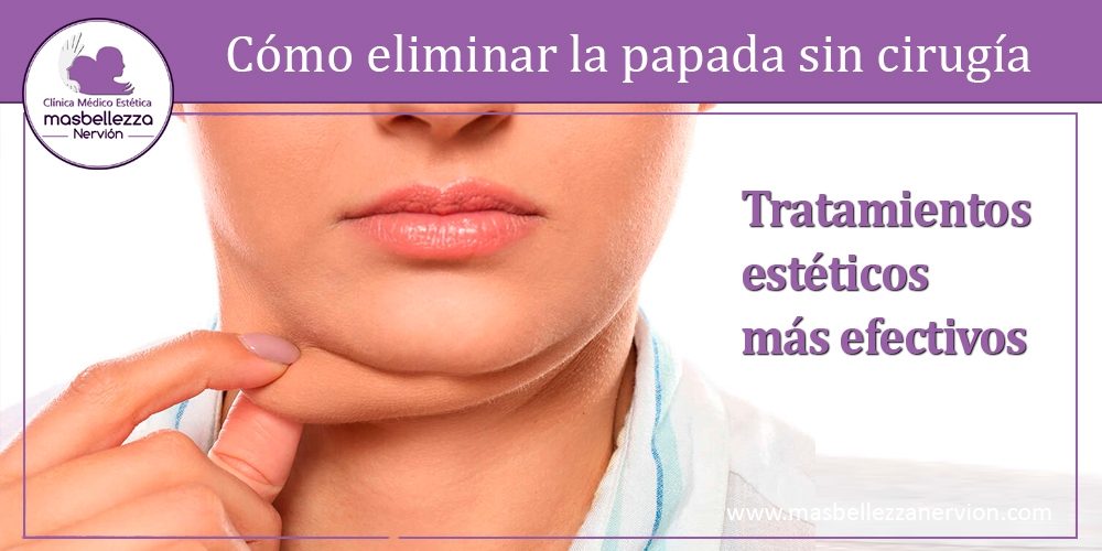 Cómo eliminar la papada sin cirugía