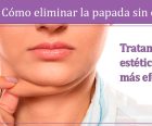 Cómo eliminar la papada sin cirugía