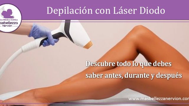 Depilación con Láser Diodo